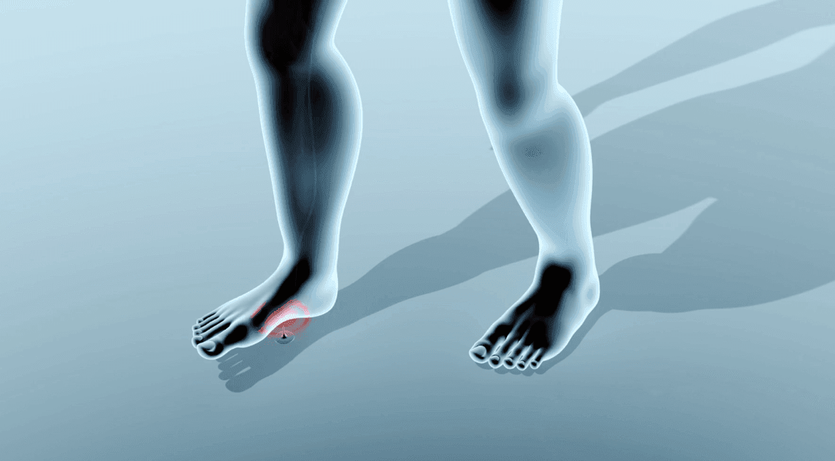 Beyond Biomechanics: The Role of Afferent Irritants in Muscular Inhibition